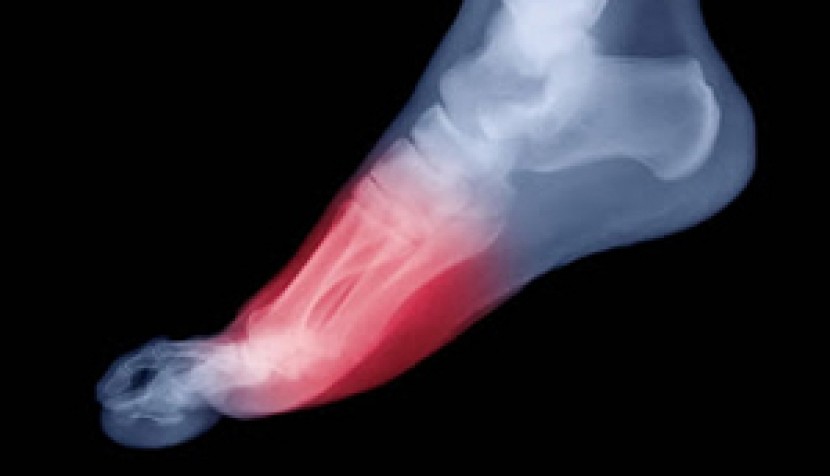 Πόνος στα μεταράρσια