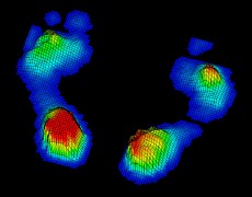 ΠΕΛΜΑΤΟΓΡΑΦΗΜΑ