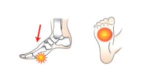 ponos-sta-metatarsia_e-podi-pic01