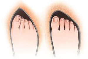 gova-stiletto-e-podi-picture-02