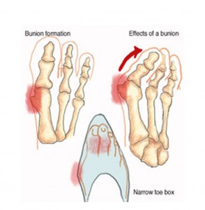 gova-stiletto-e-podi-picture-04