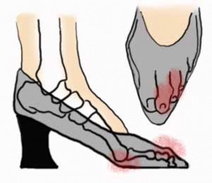 gova-stiletto-e-podi-picture-05