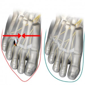 gova-stiletto-e-podi-picture-10