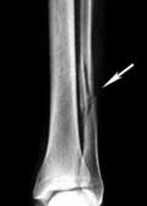 katagma-koposis-e-podi-picture-05