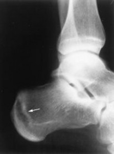 katagma-koposis-e-podi-picture-07