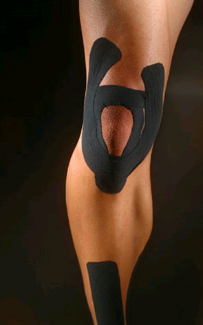 kinesio-taping-e-podi-picture-02