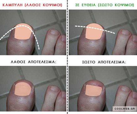 ksereis-na-koveis-ta-nyxia-sou-e-podi-picture-03