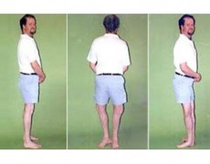 Ο ΑΝΘΡΩΠΟΣ ΜΕ ΤΑ ΑΝΑΠΟΔΑ ΠΟΔΙΑ