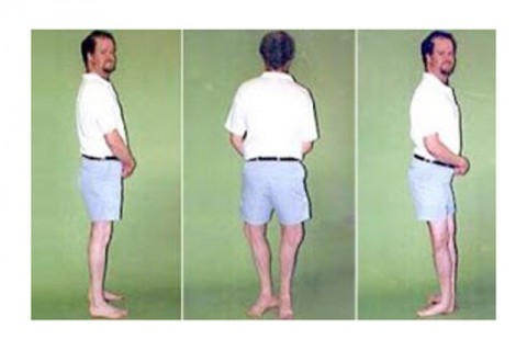 Ο ΑΝΘΡΩΠΟΣ ΜΕ ΤΑ ΑΝΑΠΟΔΑ ΠΟΔΙΑ