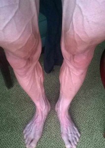 podilatis-e-podi-picture-01