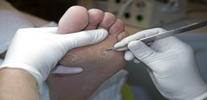 provlimata-me-kallous_e-podi-pic1