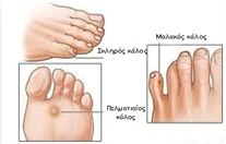 provlimata-me-kallous_e-podi-pic2