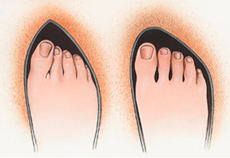 ΠΡΟΒΛΗΜΑΤΑ ΜΕ ΚΑΛΛΟΥΣ