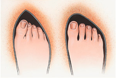 ΠΡΟΒΛΗΜΑΤΑ ΜΕ ΚΑΛΛΟΥΣ