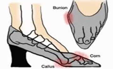 provlimata-me-kallous_e-podi-pic4