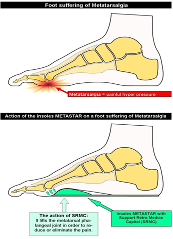 provlimata-me-kallous_e-podi-pic5
