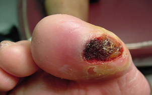 provlimata-me-kallous_e-podi-pic7