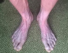 ΤΑ ΠΟΔΙΑ ΕΝΟΣ ΠΟΔΗΛΑΤΗ ΣΤΟ TOUR DE FRANCE