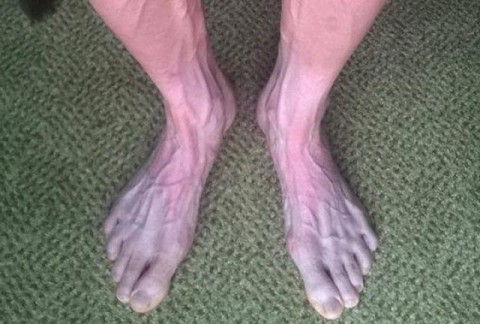 ΤΑ ΠΟΔΙΑ ΕΝΟΣ ΠΟΔΗΛΑΤΗ ΣΤΟ TOUR DE FRANCE