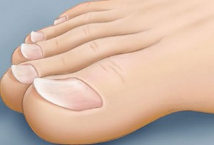 aitia-allagon-sto-derma-kai-sta-nyxia-e-podi-picture-00