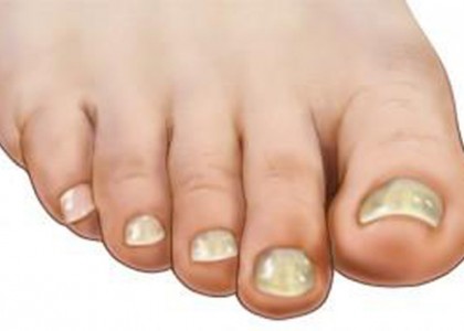 kotsi_partsinevelos.gr