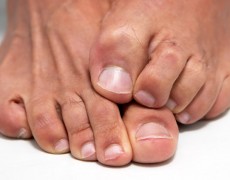 ΑΙΤΙΑ ΑΛΛΑΓΩΝ ΣΤΟ ΔΕΡΜΑ ΚΑΙ ΤΑ ΝΥΧΙΑ