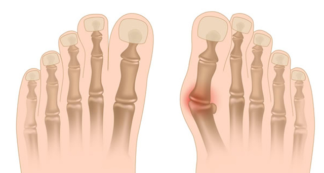 kotsi-e-podi-picture-03