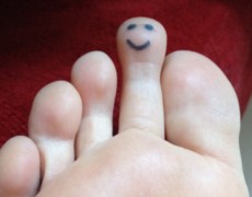 MORTON’S TOE
