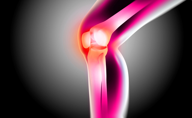 osteoarthritida-e-podi-picture-01