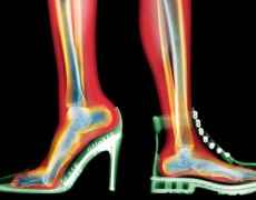 ΤΑΚΟΥΝΙΑ & ΟΣΤΕΟΑΡΘΡΙΤΙΔΑ