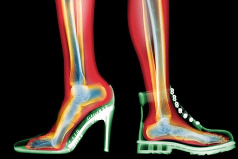 ΤΑΚΟΥΝΙΑ & ΟΣΤΕΟΑΡΘΡΙΤΙΔΑ