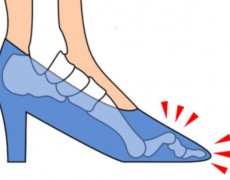 Σφυροδακτυλία