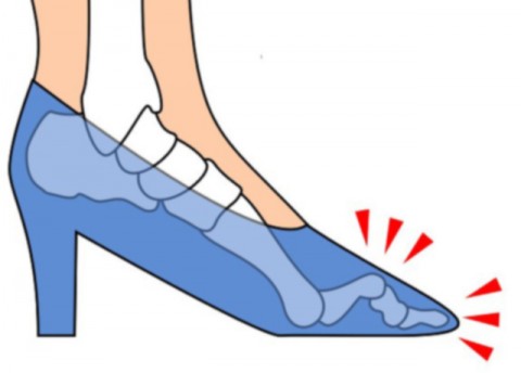 Σφυροδακτυλία