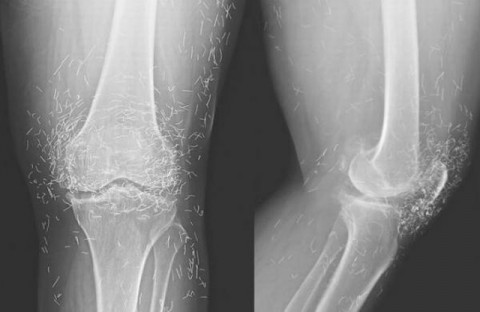 ΠΟΝΟΥΣΑΝ ΤΑ ΓΟΝΑΤΑ ΤΗΣ ΚΑΙ Ο ΓΙΑΤΡΟΣ ΒΡΗΚΕ ΟΤΙ ΕΙΧΕ…