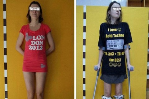 ΧΕΙΡΟΥΡΓΕΙΟ ΓΙΑ ΛΙΓΑ ΕΚΑΤΟΣΤΑ ΥΨΟΥΣ…!