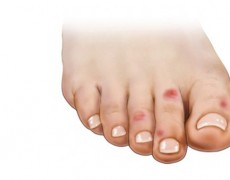 ΧΙΟΝΙΣΤΡΕΣ