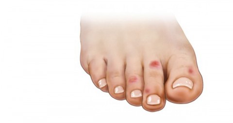 ΧΙΟΝΙΣΤΡΕΣ