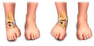 diastrema-ola-osa-prepei-na-gnorizete-e-podi-picture-04