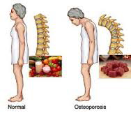 diatrofi-kai-podi-e-podi-picture-02