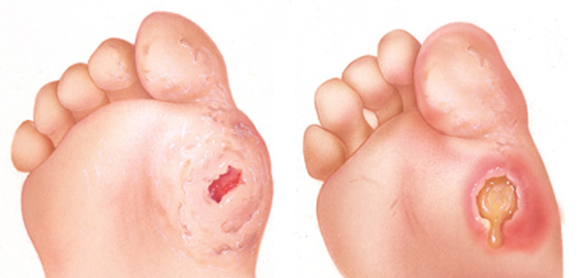 fouskales-e-podi-picture-01