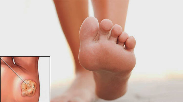 myrmigkies-e-podi-picture-03