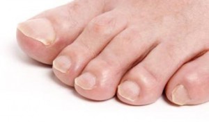 podia-karkinos-e-podi-picture-02