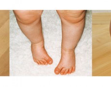 ΠΟΔΙΑ ΠΟΥ ΣΤΡΙΒΟΥΝ ΠΡΟΣ ΤΑ ΜΕΣΑ