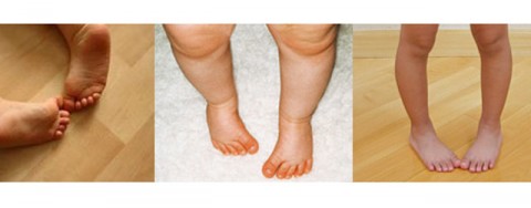 ΠΟΔΙΑ ΠΟΥ ΣΤΡΙΒΟΥΝ ΠΡΟΣ ΤΑ ΜΕΣΑ