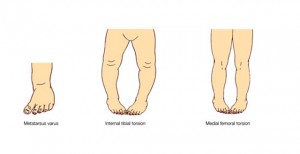 podia-poy-strivoun-pros-ta-mesa-e-podi-picture-02