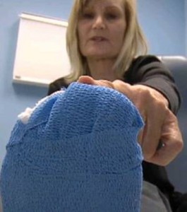 xeirourgeio-gia-na-foresei-psila-takounia-e-podi-picture-02