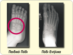 ti-noumero-papoutsi-forao-e-podi-picture-03