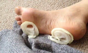 valte-kremydia-sta-podia-sas-prin-koimithite-e-podi-picture-02