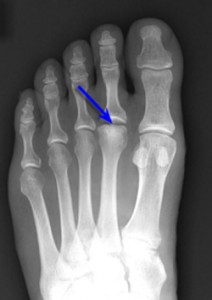 FREIBERG-e-podi-picture-02