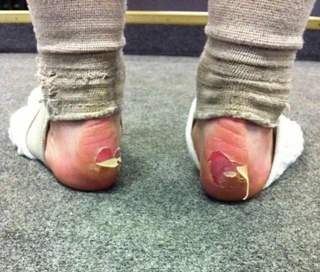 mpaleto-mia-texni-gia-dynates-gynaikes-e-podi-picture-06